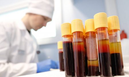 pruebas de sangre a peronas con VIH