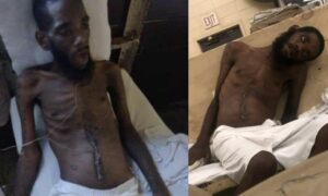 Familia comparte imágenes perturbadoras de recluso de Alabama y dice que necesita ayuda