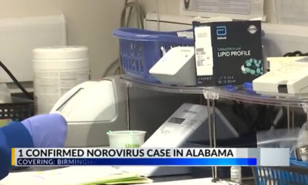 El norovirus llega a Alabama. Lo que dicen los médicos