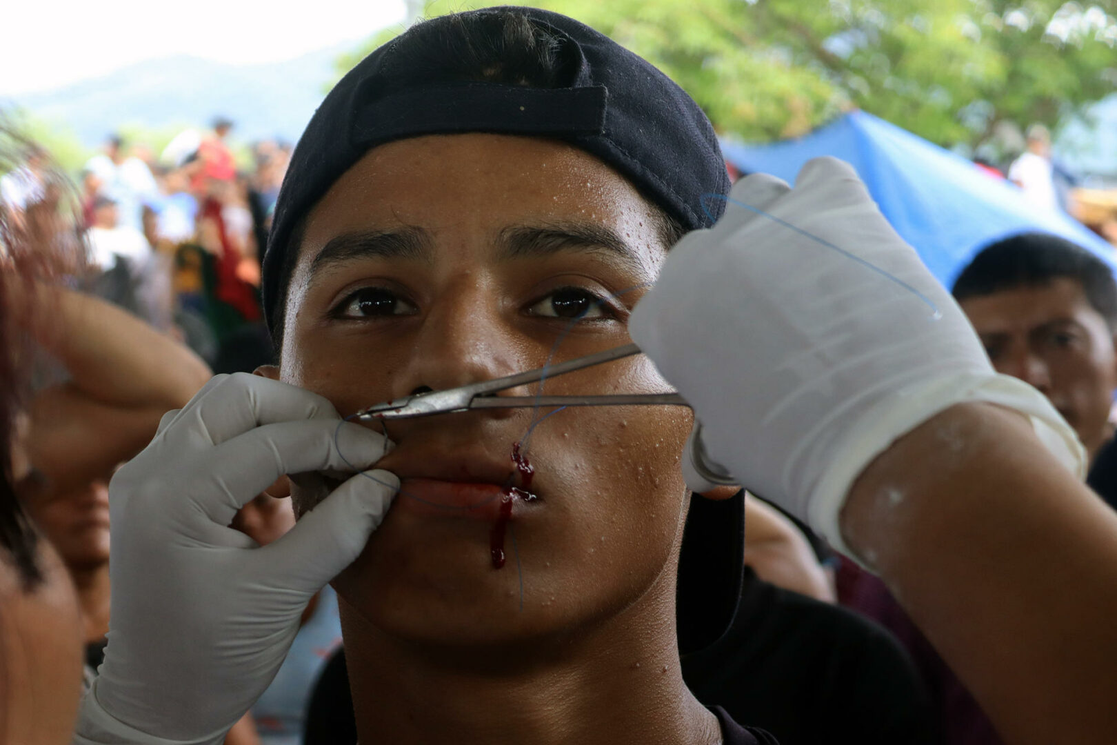 Migrantes se cosen la boca para pedir documentos de tránsito en sur de México